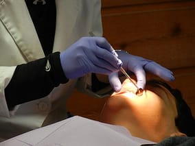 dental check up