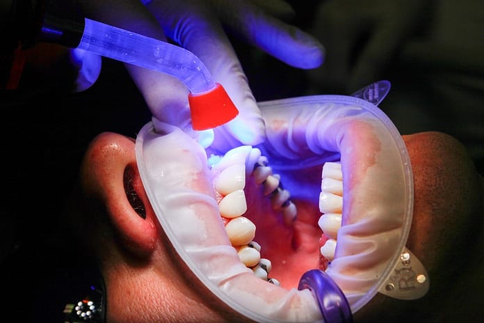 dental procedure 